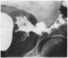 182