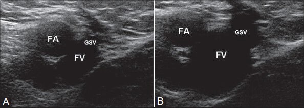 Figure 9 (A, B)