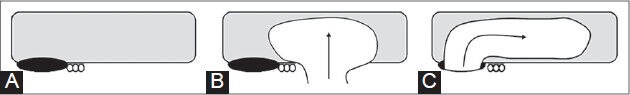 Figure 5 (A-C)