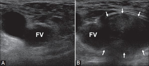 Figure 10 (A, B)