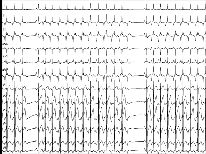 Fig. 1.