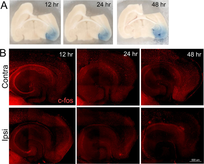 Figure 6—figure supplement 1.