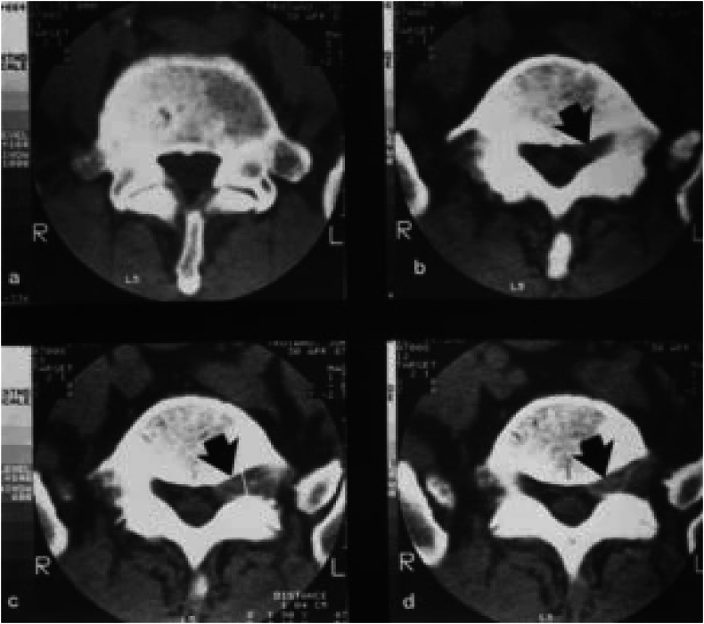 Fig. 10