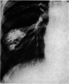 384-2