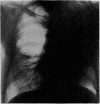 384-2