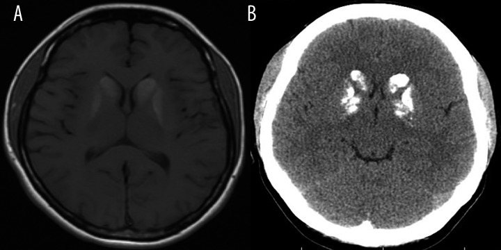 Figure 16