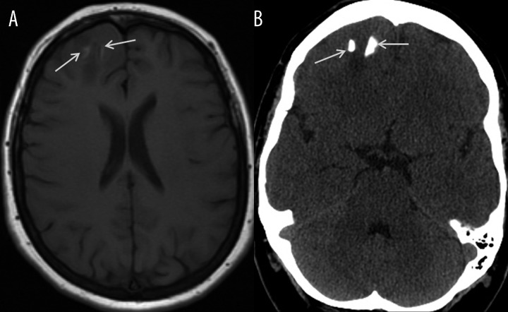 Figure 15