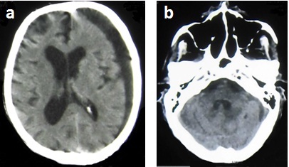 [Table/Fig-1a,b]: