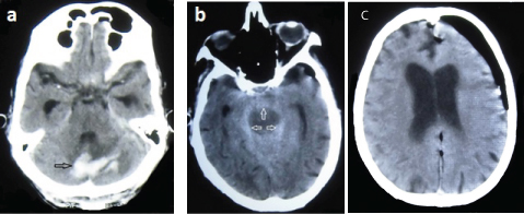 [Table/Fig-2a,b]: