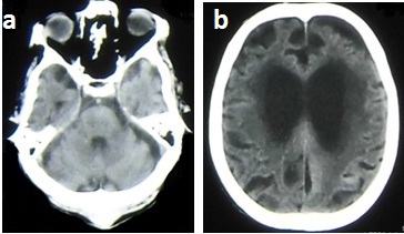 [Table/Fig-3a,b]: