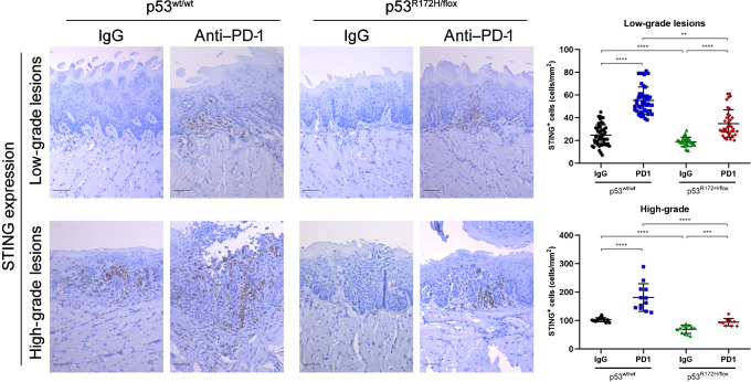 Figure 5. Local delivery of anti–PD-1 increases STING protein levels in low- and high-grade lesions. Representative IHC images of STING expression in oral lesions. A, significant difference of STING expression was detected between untreated and PD-1 treated mice groups. Immunostaining signal was defined as the number of positive cells per mm2. Right graphs: **, P <0.01; ***, P < 0.001; ****, P < 0.0001. Scale bar, 50 μm.