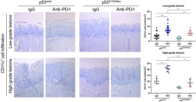 Figure 6. PD-1 blockage promoted recruitment of CD11c+ DCs into oral lesions of wild-type and mutant p53 mice. Representative IHC images of CD11c DCs in oral lesions. A significant difference of CD11+ cells was detected between untreated and PD1-treated mice groups. Immunostaining signal was defined as the number of positive cells per mm2. Right graphs: **, P <0.01; ***, P < 0.001; ****, P < 0.0001. Scale bar, 50 μm.