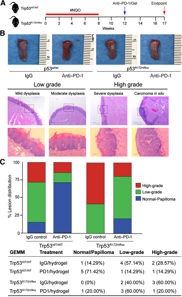 Figure 1. Experimental carcinogen-induced mouse model and local immunotherapy delivery reduces oral lesion incidence. A, Study timeline and end points for immunotherapy studies. B, Representative lesions and histopathology of 4NQO-induced oral lesions in the mouse tongue, scale ruler (mm). Photomicrographs show the histopathologic progression in this model system, mild, moderate, severe dysplasia, and carcinoma in situ. Scale bars, 200 and 50 μm, top and bottom panels, respectively. C, The square shows a magnification area of each histologic stage, and the table below the graph represents the incidence of normal, low-, and high-grade incidence of lesions after treatment in each mouse group (n = 5–7).