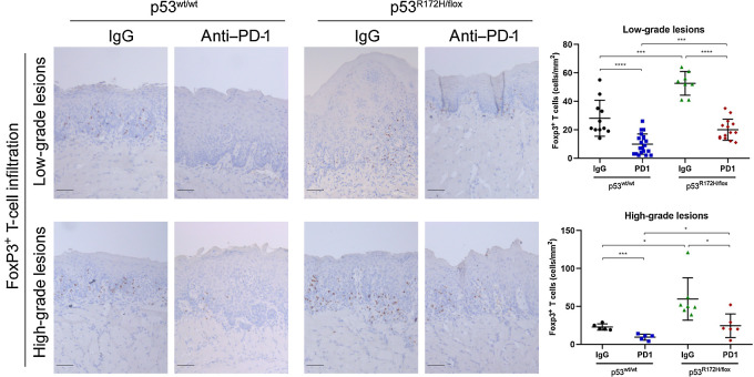 Figure 4. PD1 blockage reduced the infiltration of Foxp3+ T cells in low- and high-grade oral lesions. Mutant p53 mice showed a higher Foxp3+ T-cell infiltration compared with wild-type mice. PD-1 hydrogel reduced the numbers of positive Foxp3+ T cells in low- and high-grade oral lesions. Immunostaining signal was defined as the number of positive cells per mm2. Right graphs: *, P < 0.05; ***, P < 0.001; ****, P < 0.0001. Scale bar, 50 μm.