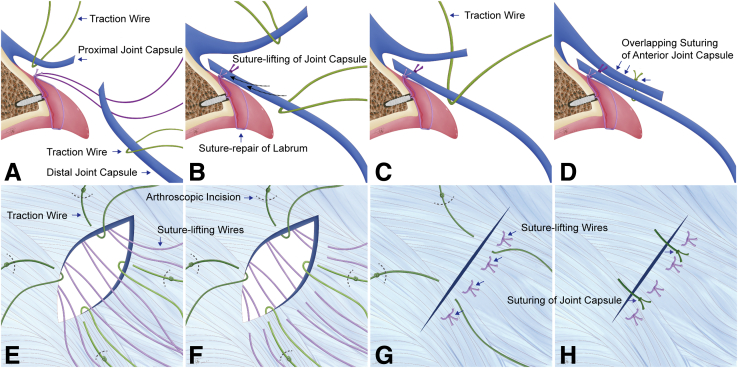 Fig 1