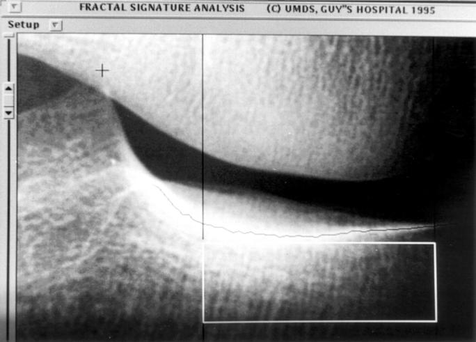 Figure 1  