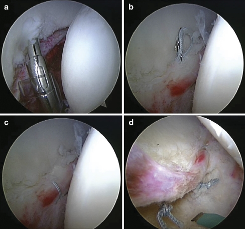 Fig. 3