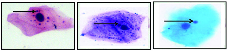 [Table/Fig-10]: