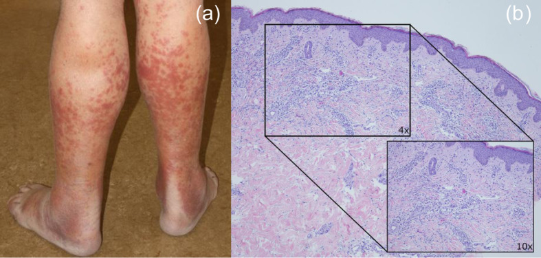Fig. 1