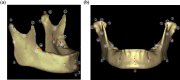 Fig.2