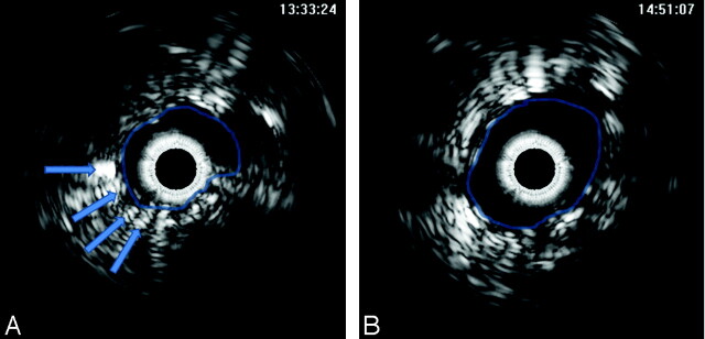 Fig 2.