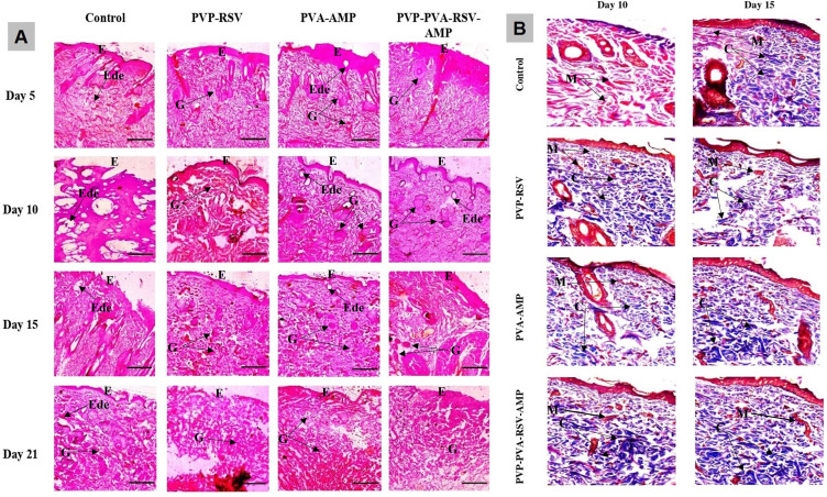 Figure 11