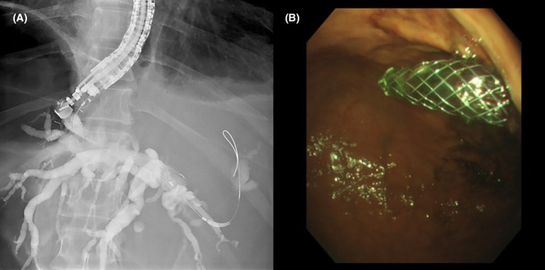 Figure 2