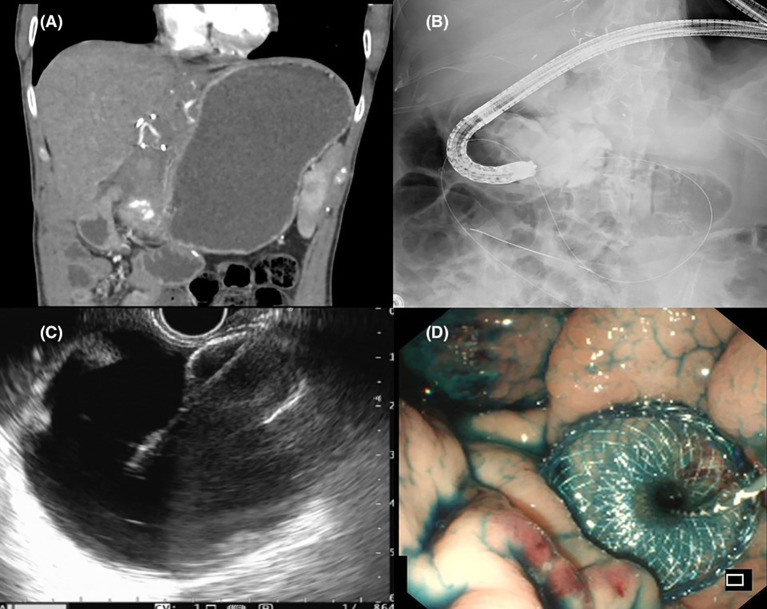 Figure 3