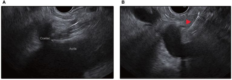 Figure 4