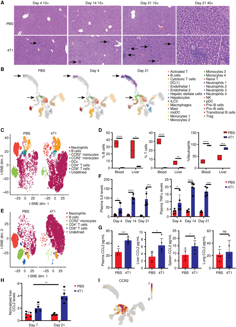 Figure 2. Innate immune cells infiltrate the host's liver during early breast carcinogenesis. A, Hematoxylin and eosin staining of liver sections demonstrates increased immune cell infiltration along a time course following breast cancer cell injection. The black arrows point to the infiltrating immune cells. Magnifications: 10 and 40× as detailed in the figure. B, Cell types annotated from the scRNA-seq analysis are projected on three uniform manifold approximation and projections (UMAP), indicating which cells appear at which time point. The arrows mark the neutrophil and monocyte subsets that were absent in the liver of WT mice and gradually accumulated in the liver until day 21. DC, dendritic cell; moDC, monocyte-derived dendritic cell; NK, natural killer; pDC, plasmacytoid dendritic cell; Treg, regulatory T cell. C–E, CyTOF-t-distributed stochastic neighbor embedding (t-SNE) analysis (C and E) and (D) quantification of liver and blood CD45+ populations show increased levels of innate immune cells and reduction of lymphocytes in the liver (C) and blood (E) of breast cancer–bearing mice compared with WT PBS-injected mice (WT n = 3, 4T1 = 5, Student t test). P values for blood <0.0001. P values for liver: B cells = 0.013, T cells = 0.0014, neutrophils = 0.0001. F, Multiplex ELISA immunoassay demonstrates increasing levels of IL6 (left) and TNFα (right) in breast cancer–bearing mice from day 4 to day 21 following cancer cell injection (n = 5, Student t test). P values for IL6: day 4 = 0.024, day 14 <0.0001, and day 21 = 0.0009. P values for TNFα: day 4 = 0.05, day 14, and day 21 <0.0001. G, ELISA assay measurements of CCL2 levels in plasma, livers, spleens, and lungs of breast cancer–bearing mice (n = 5, Student t test). P values: plasma = 0.0005, liver = 0.017, spleen = 0.04. H, ELISA assay demonstrates a significant interaction effect between the time following cancer cell injection and elevation of CCL2 in the liver of breast cancer–bearing mice relative to WT PBS-injected mice (n = 5, two-way ANOVA); P = 0.0034. I, Expression of CCR2 in immune cells from the scRNA-seq experiment, projected on the UMAP, demonstrates that CCR2 is mainly expressed in monocyte subpopulations.