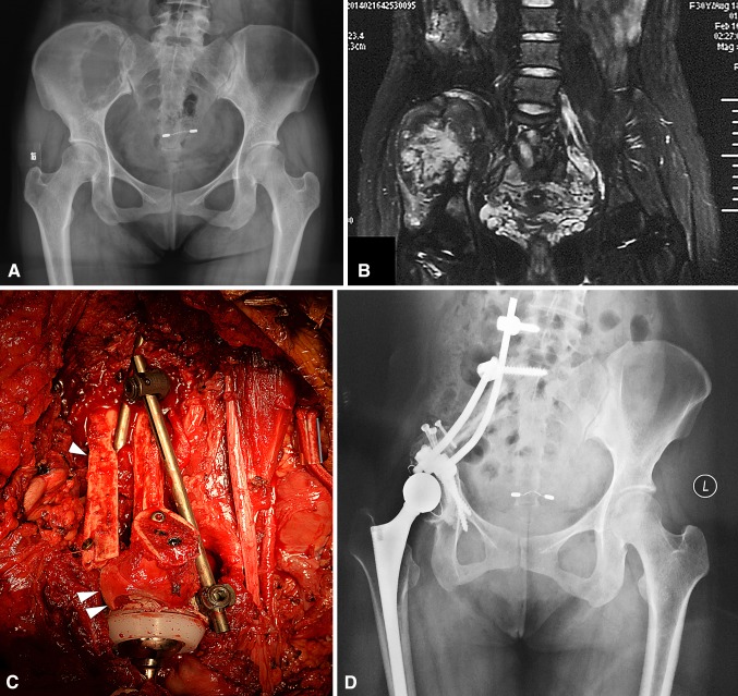 Fig. 3A–H