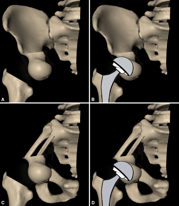 Fig. 2A–D