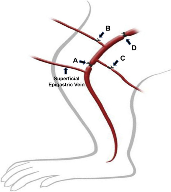 Fig. 1