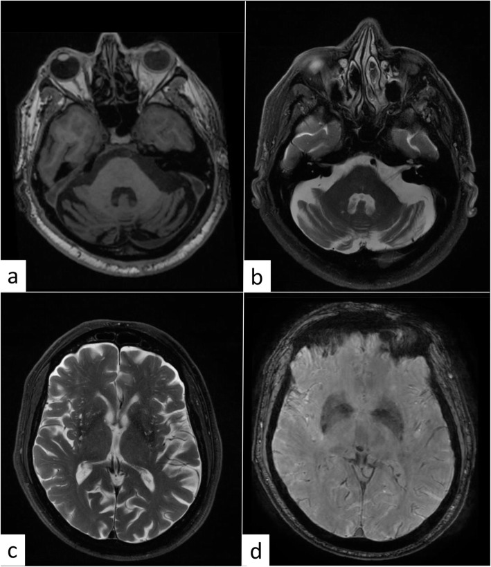 Fig. 1