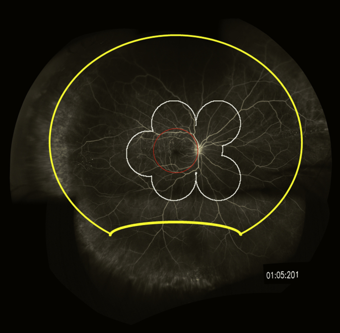 Fig. 2