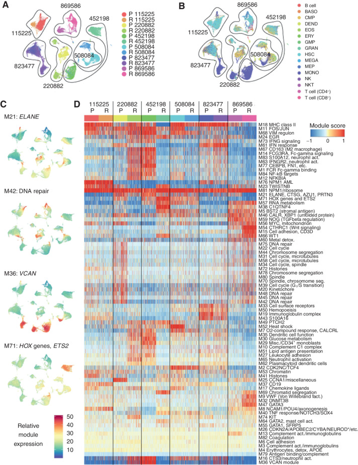 Figure 3. Individual AML samples express unique combinations of gene modules. A, UMAP representation of scRNA-seq data from all AML samples generated after excluding lymphocyte clusters (T cells, B cells, and NK cells), with cells colored by sample. These cells were used to identify gene modules using the WGCNA algorithm. B, Cells colored by inferred lineage using DMAP data. C, UMAPs colored according to the single-cell expression of selected representative modules. Top to bottom: module 21 (ELANE, etc.), module 42 (DNA repair), module 36 (VCAN), and module 71 (HOX genes and ETS2). D, Clustered heatmap of WGCNA gene module expression (labeled “Module score” in the key) in individual cells from each sample. *NEUROD indicates that multiple NEUROD genes were present. act., activation; BASO, basophil; DEND, dendritic cell; detox., detoxification; EOS, eosinophil; ERY, erythrocyte; fact. factor; GMP, granulocyte–monocyte progenitor; GRAN, granulocyte; MEGA, megakaryocyte; MEP, megakaryocyte–erythroid progenitor; Misc., miscellaneous; MONO, monocyte; NKT, natural killer T cell; P, presentation; R, relapse; seg, segregation.