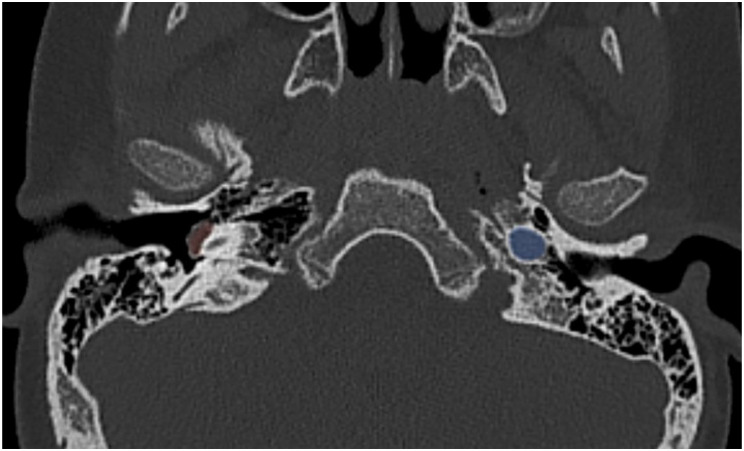 Figure 11.