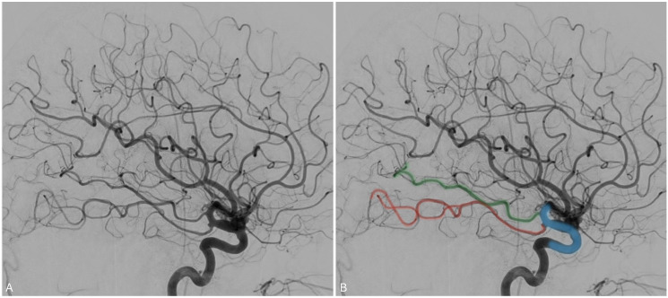 Figure 3.