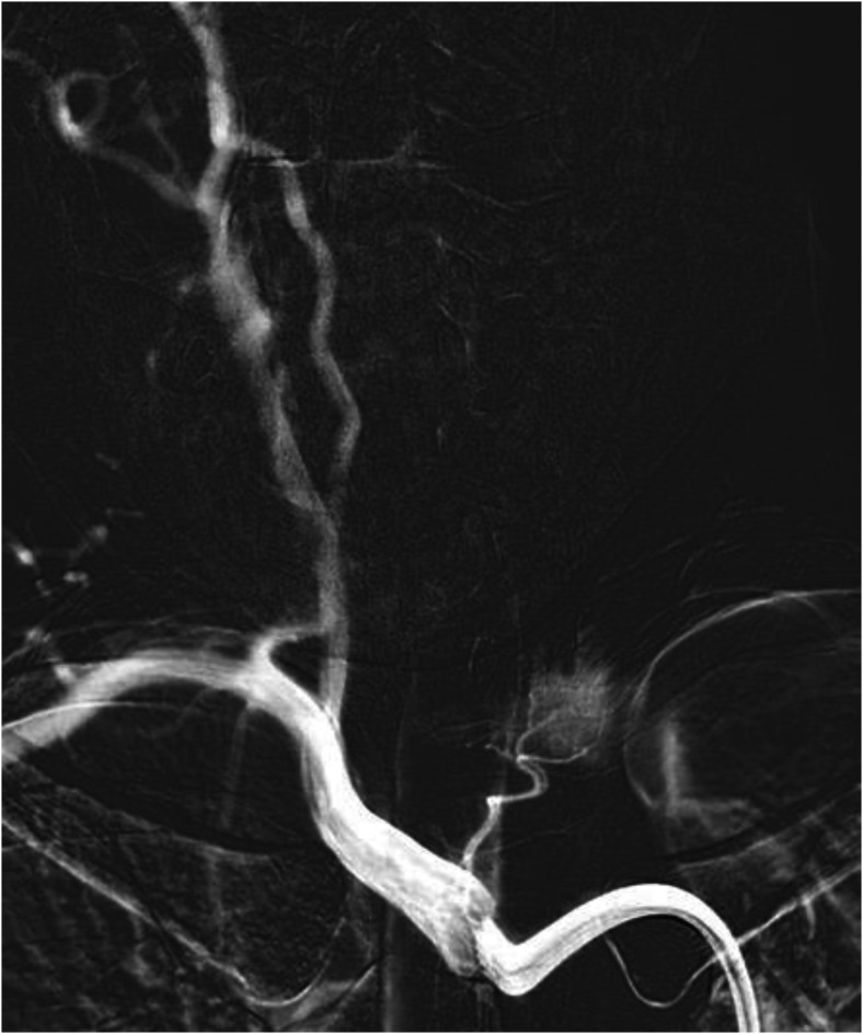 Figure 14.