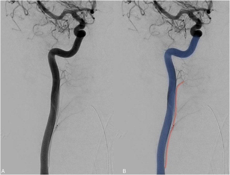 Figure 12.