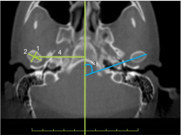 Figure 2