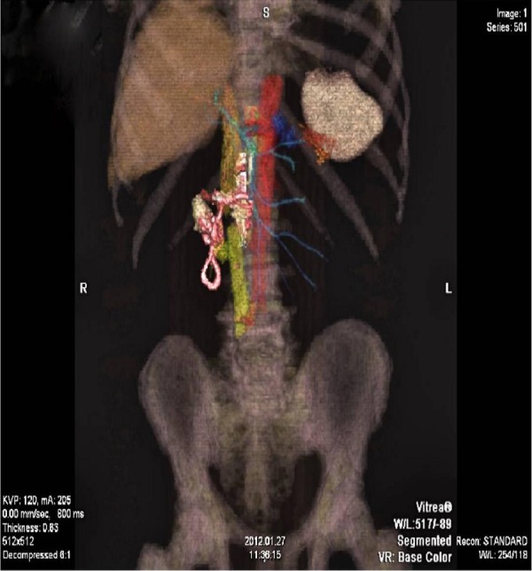 Figure 3