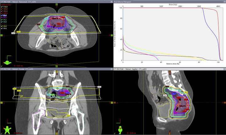 Figure 1