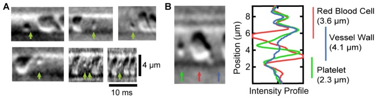 Fig. 12