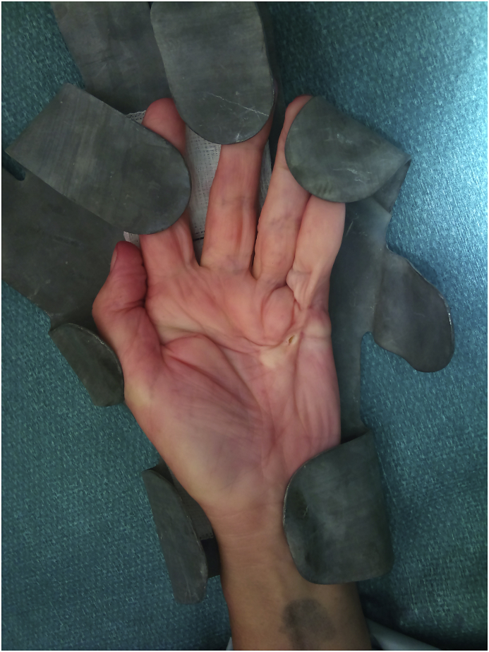 Fig. 1a