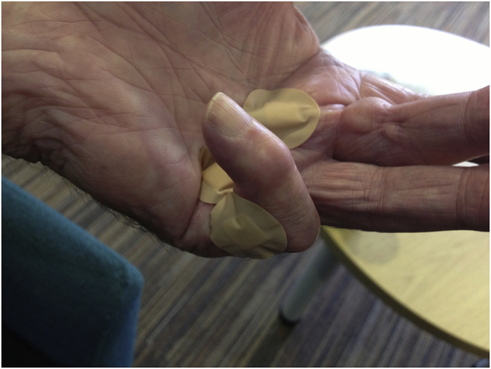 Fig. 3b