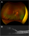 Fig. 2