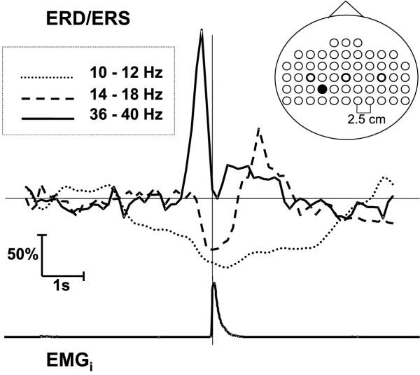 Figure 23