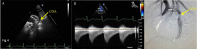 Fig 5