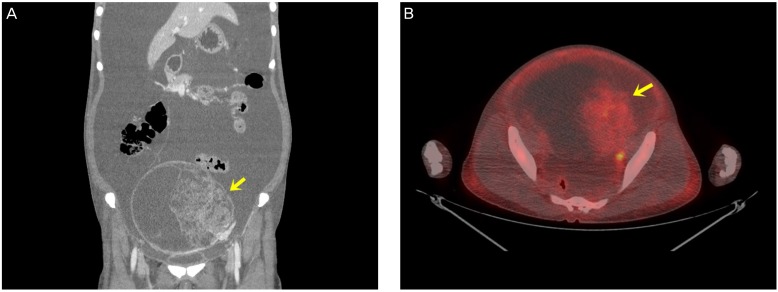 Fig. 1